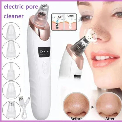Digital Blackhead Remover Vacuum
