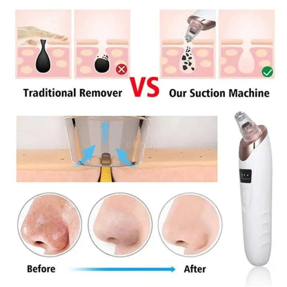 Digital Blackhead Remover Vacuum