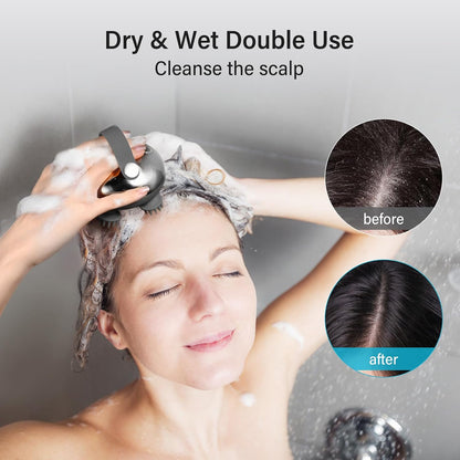 Arboleaf Cordless Electric Head and Scalp Massager